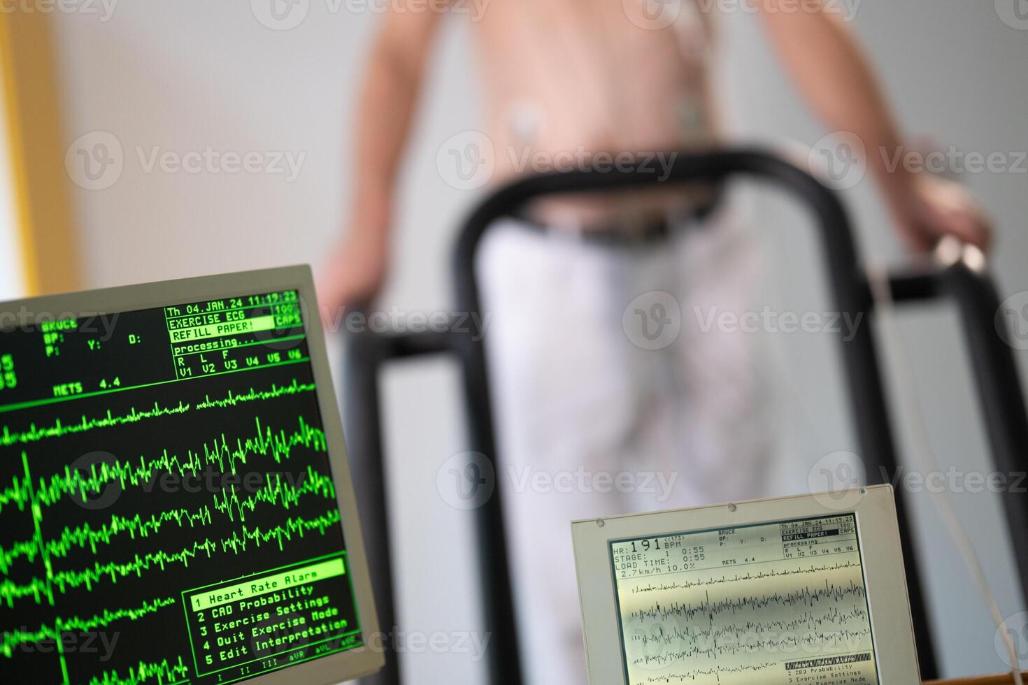 A middle-aged man is undergoing a medical stress test on a treadmill, connected to ECG electrodes for heart monitoring in a clinical environment photo