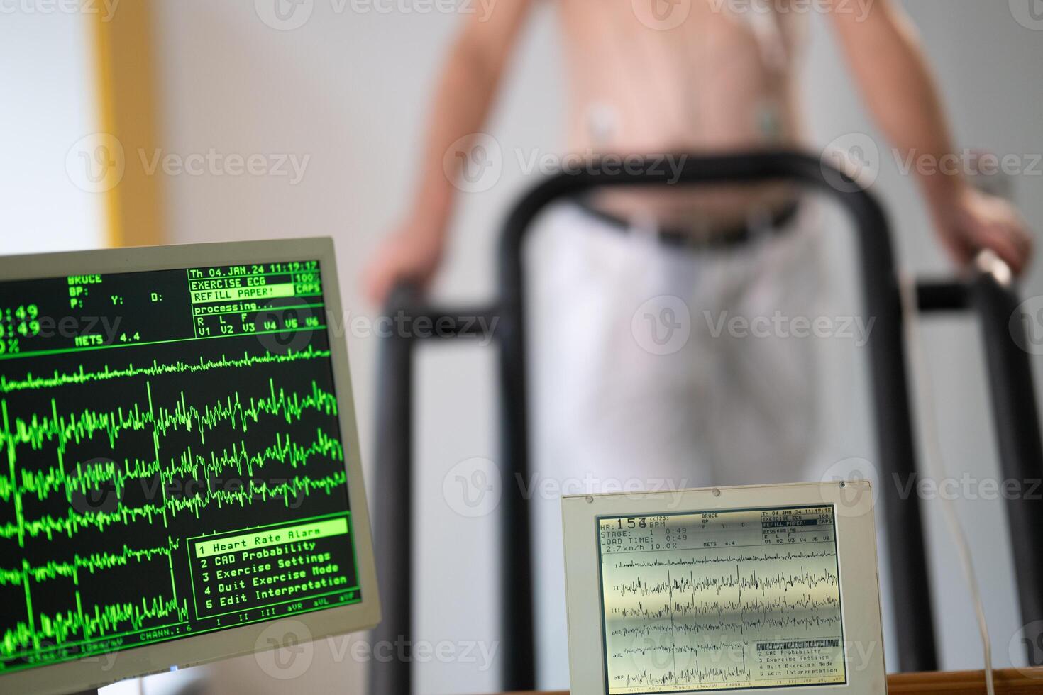 A middle-aged man is undergoing a medical stress test on a treadmill, connected to ECG electrodes for heart monitoring in a clinical environment photo