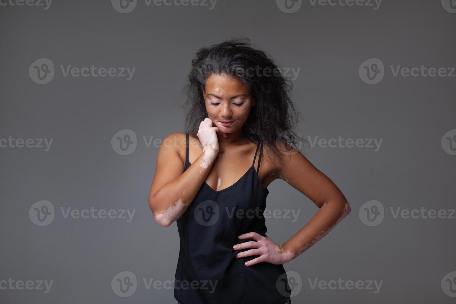Sensuous female fashion model with vitiligo in black tank top photo