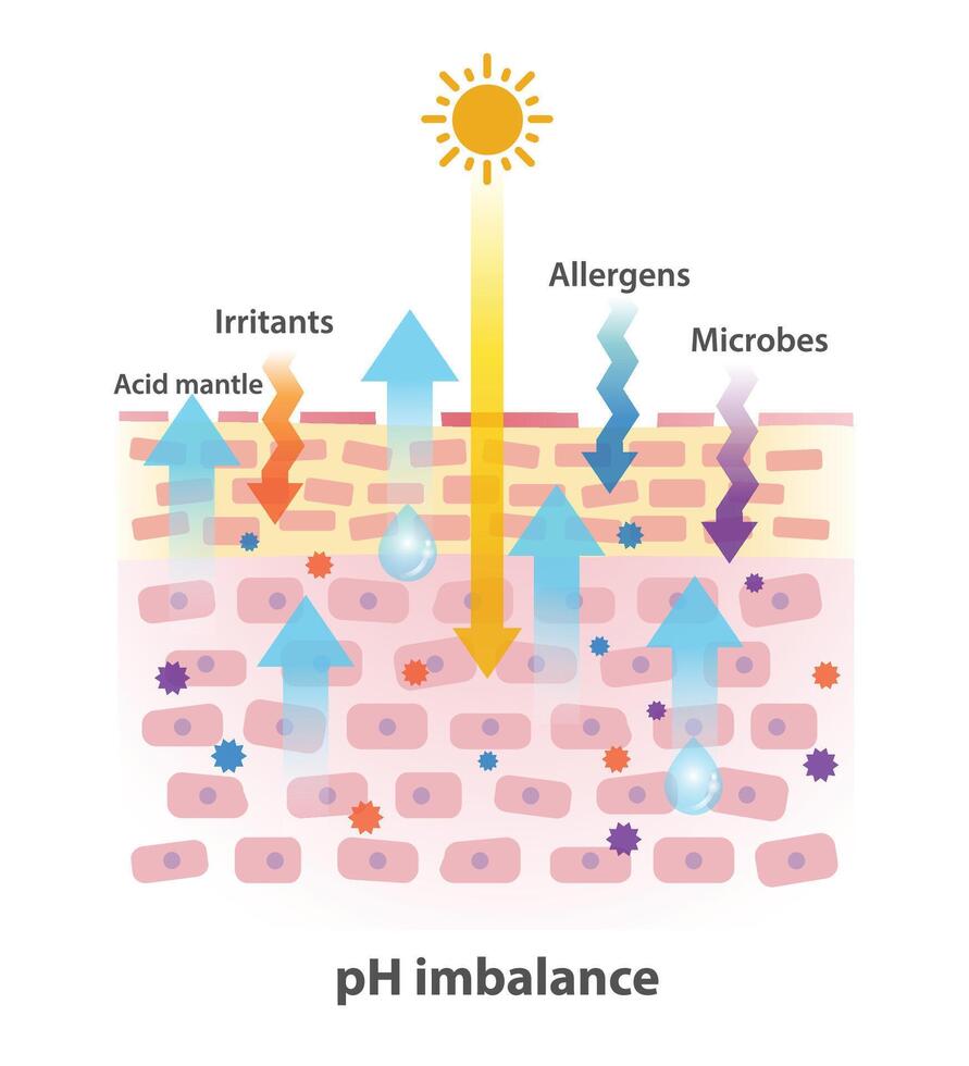 Cross section of skin pH level imbalance illustration. The mechanism of damaged skin barrier. UV rays, irritants, allergens and microbes is factors that can disrupt the acid mantle and pH balance. vector
