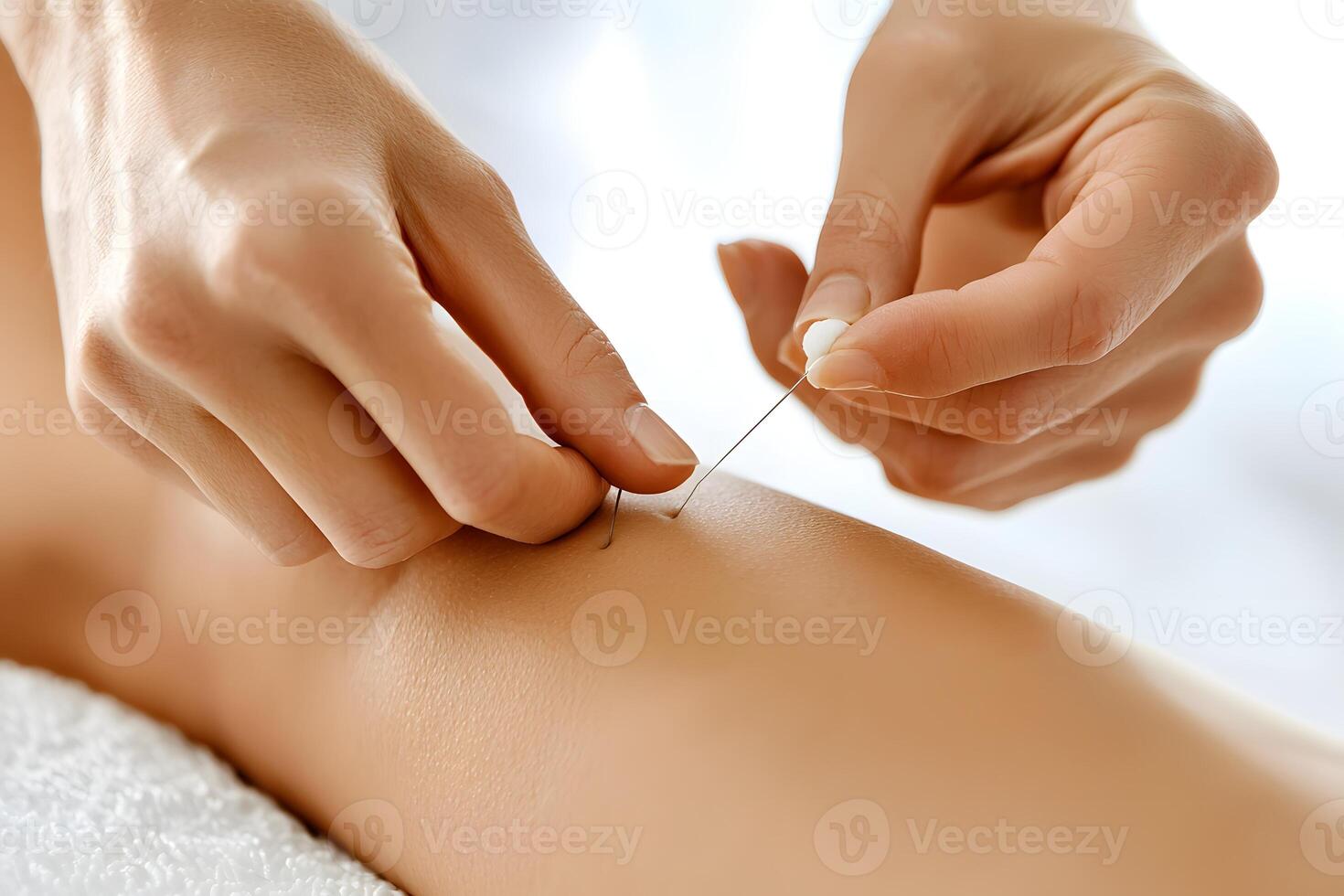 Acupuncture Treatment Close up of Hands Inserting Needle into Leg photo
