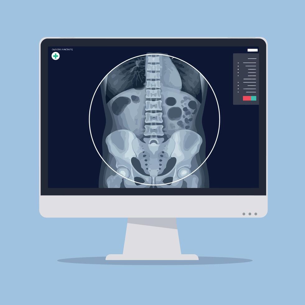 Detailed medical illustration of a spine and pelvis on a flat design computer screen art vector