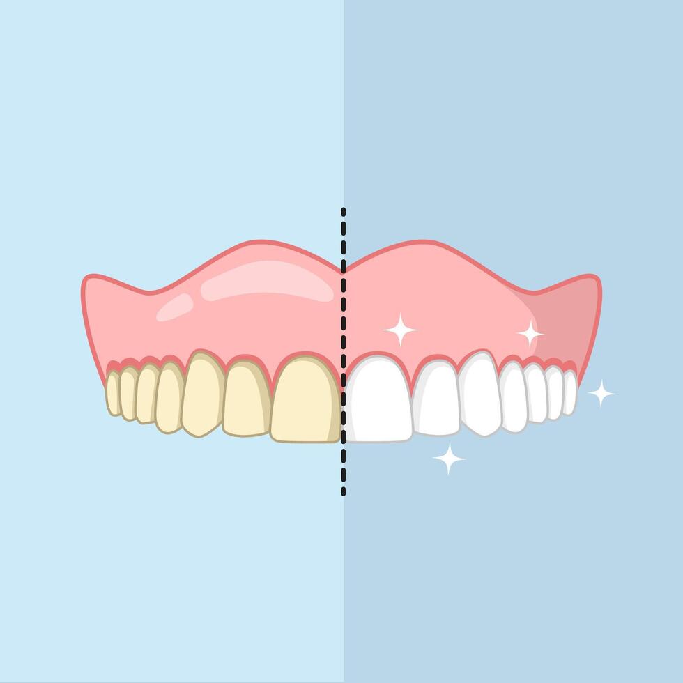 Clean and dirty teeth, whiten or clean teeth illustration vector