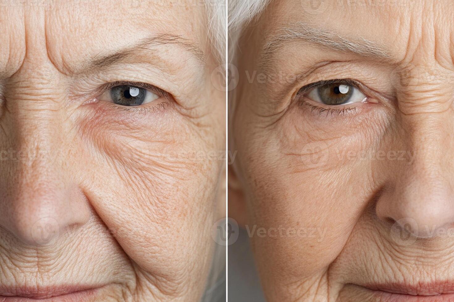 Two images of an older woman's face before and after photo