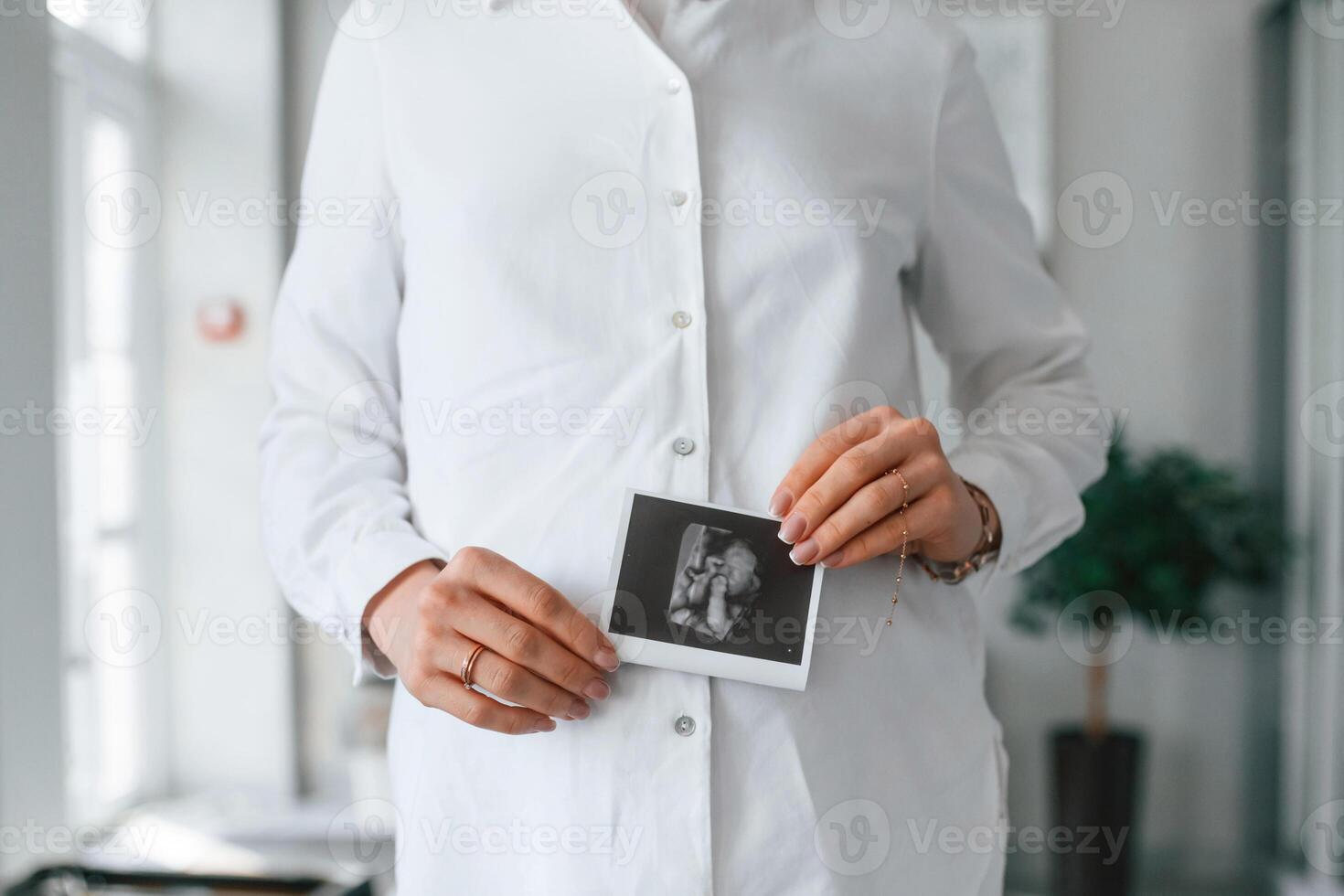 Woman in white coat is holding ultrasound picture of baby photo, photo