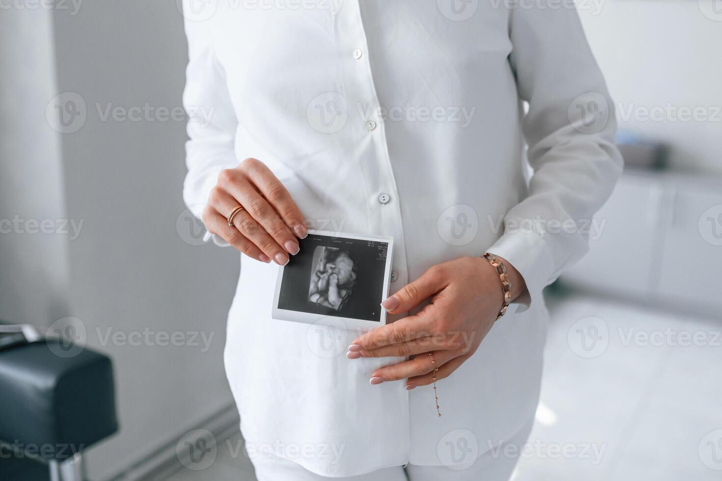 Woma,n in white ,coat is holding ultrasound picture of baby photo