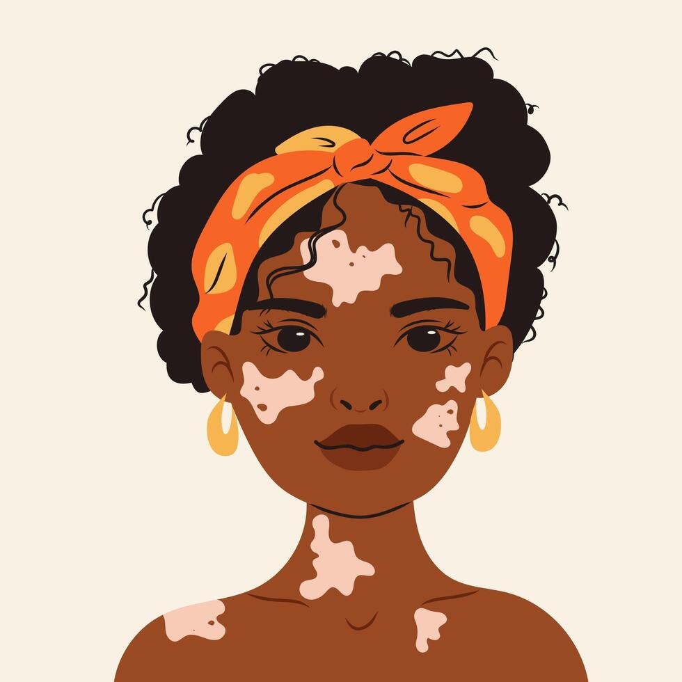 Portrait of a happy dark skinned woman with vitiligo, promoting self acceptance and body positivity . Diverse beauty , hand drawn illustration in flat style isolate on white . vector