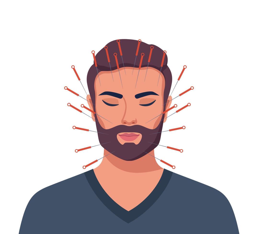 Acupuncture. Man with closed eyes and needles in her face. Alternative Oriental Medicine. illustration. vector