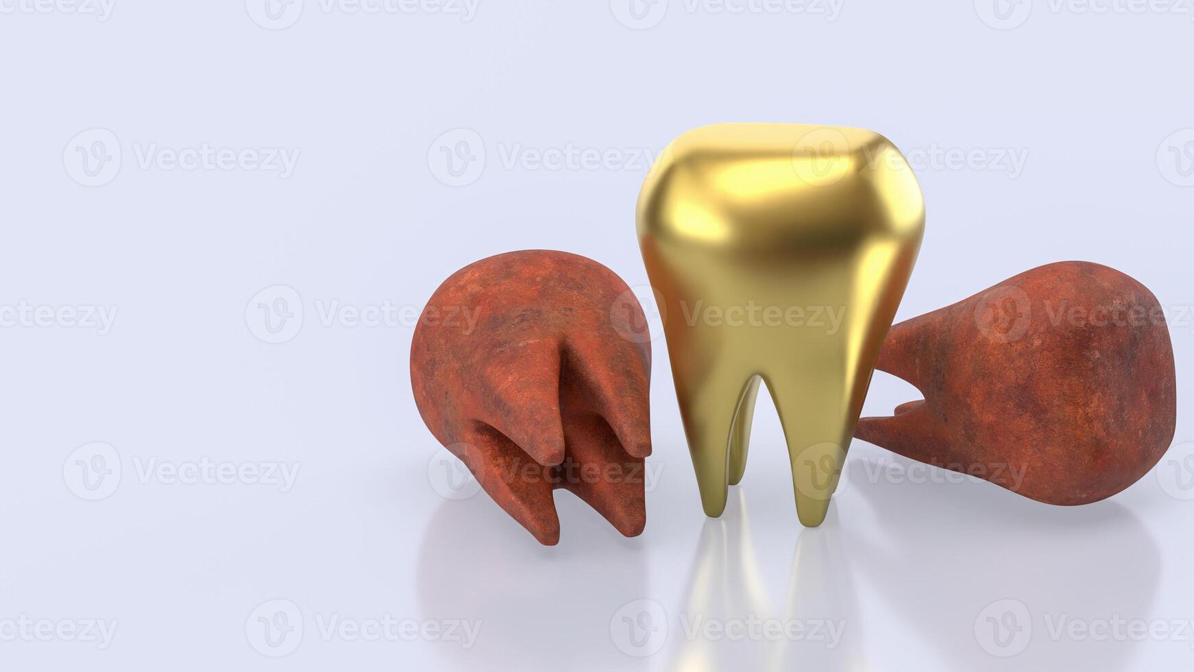 The Gold teeth for Dental concept 3d Rendering. photo