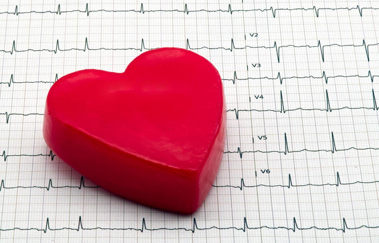 Heart-shaped object on EKG graph paper, representing health and medical concepts. photo