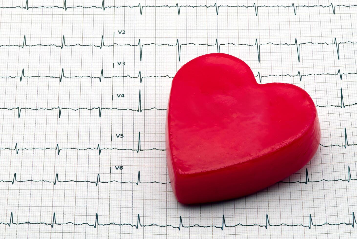Heart shaped object on a standard electrocardiogram, ekg, graph paper. photo