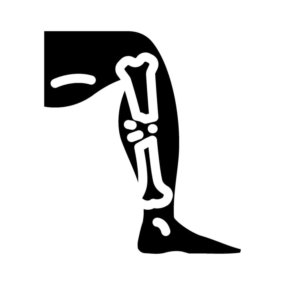 broken leg fracture injury glyph icon illustration vector