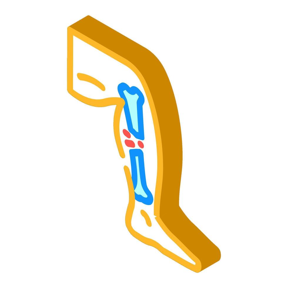broken leg fracture injury isometric icon illustration vector