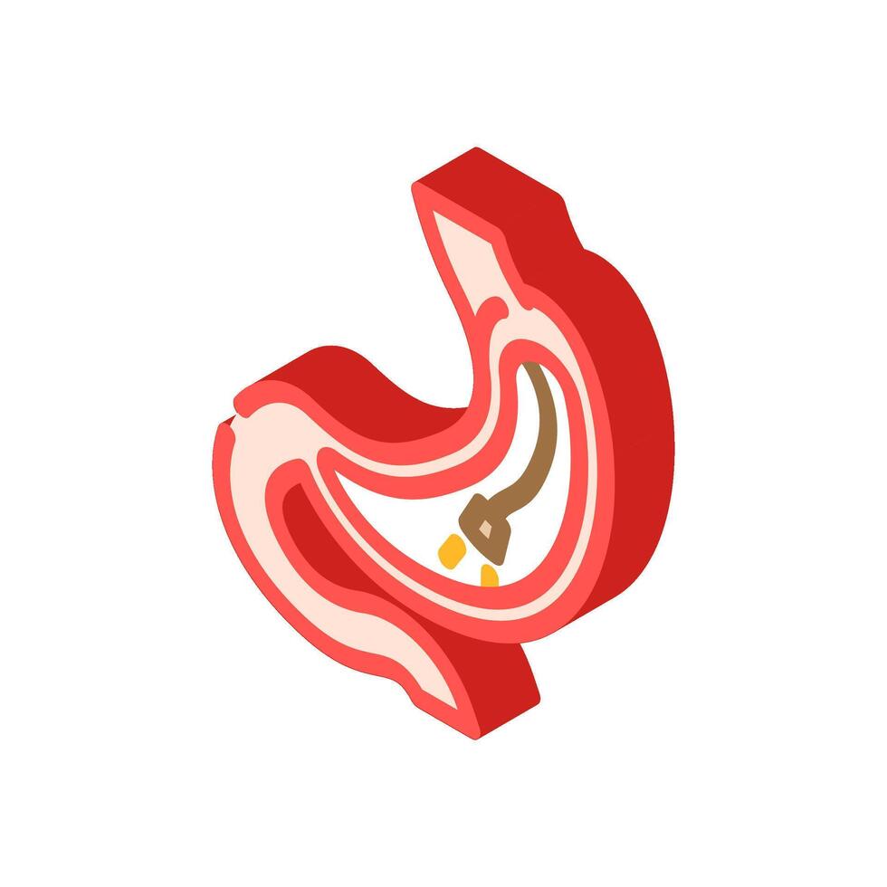 gastroscopy procedure gastroenterologist isometric icon illustration vector