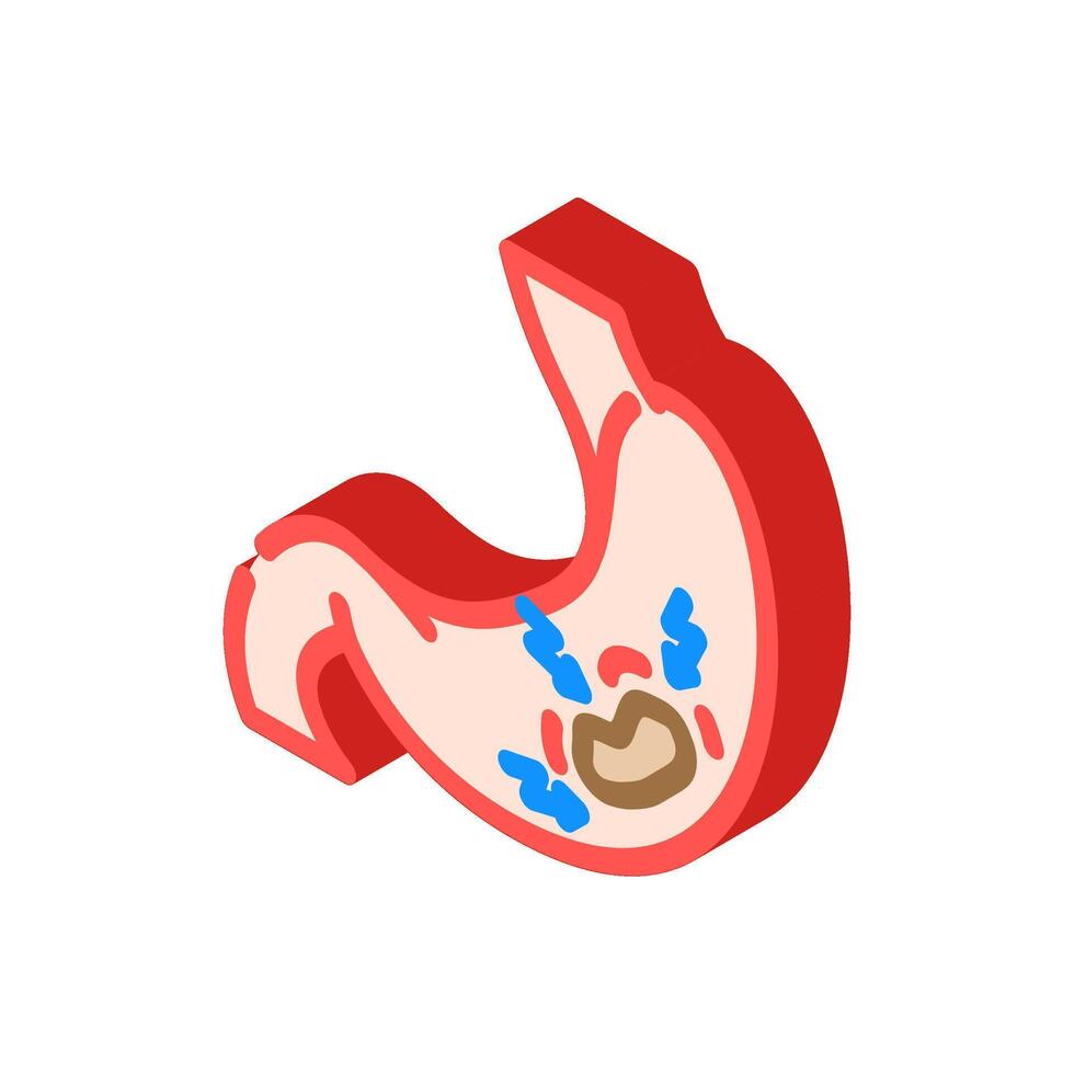 gastric ulcer gastroenterologist isometric icon illustration vector