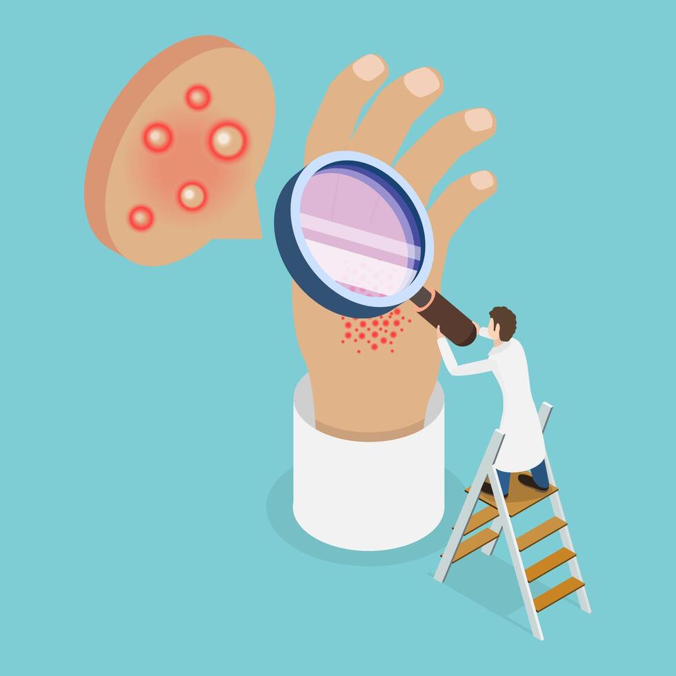 3D Isometric Flat Conceptual Illustration of Atopic Dermatitis, Patient Skin Allergic Reaction vector