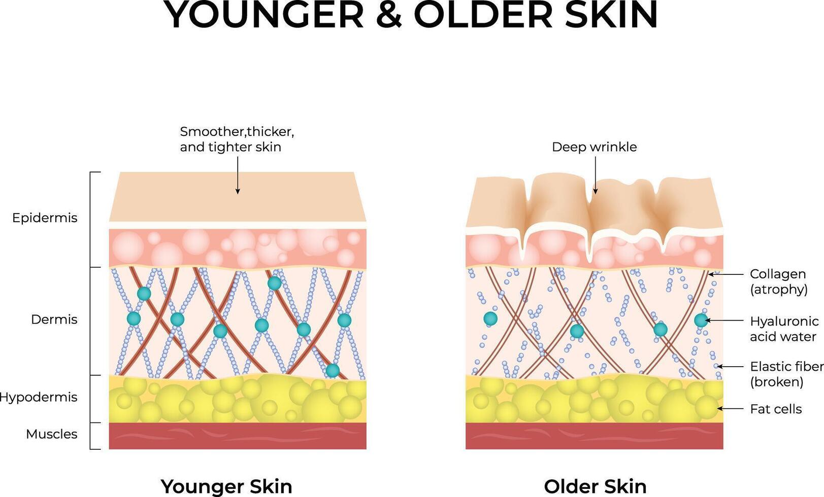Younger vs Older Skin A Comparison of Skin Structure and Aging Illustration vector