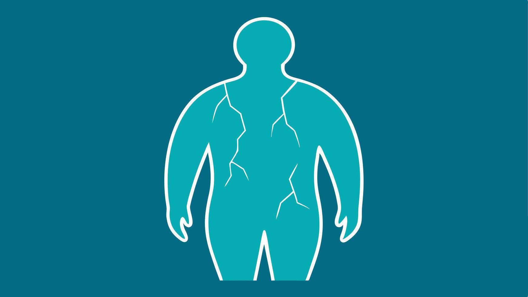 Crumbling Body An outline of a body that appears to be breaking apart or crumbling visualizing how chronic loneliness can affect physical health.. vector