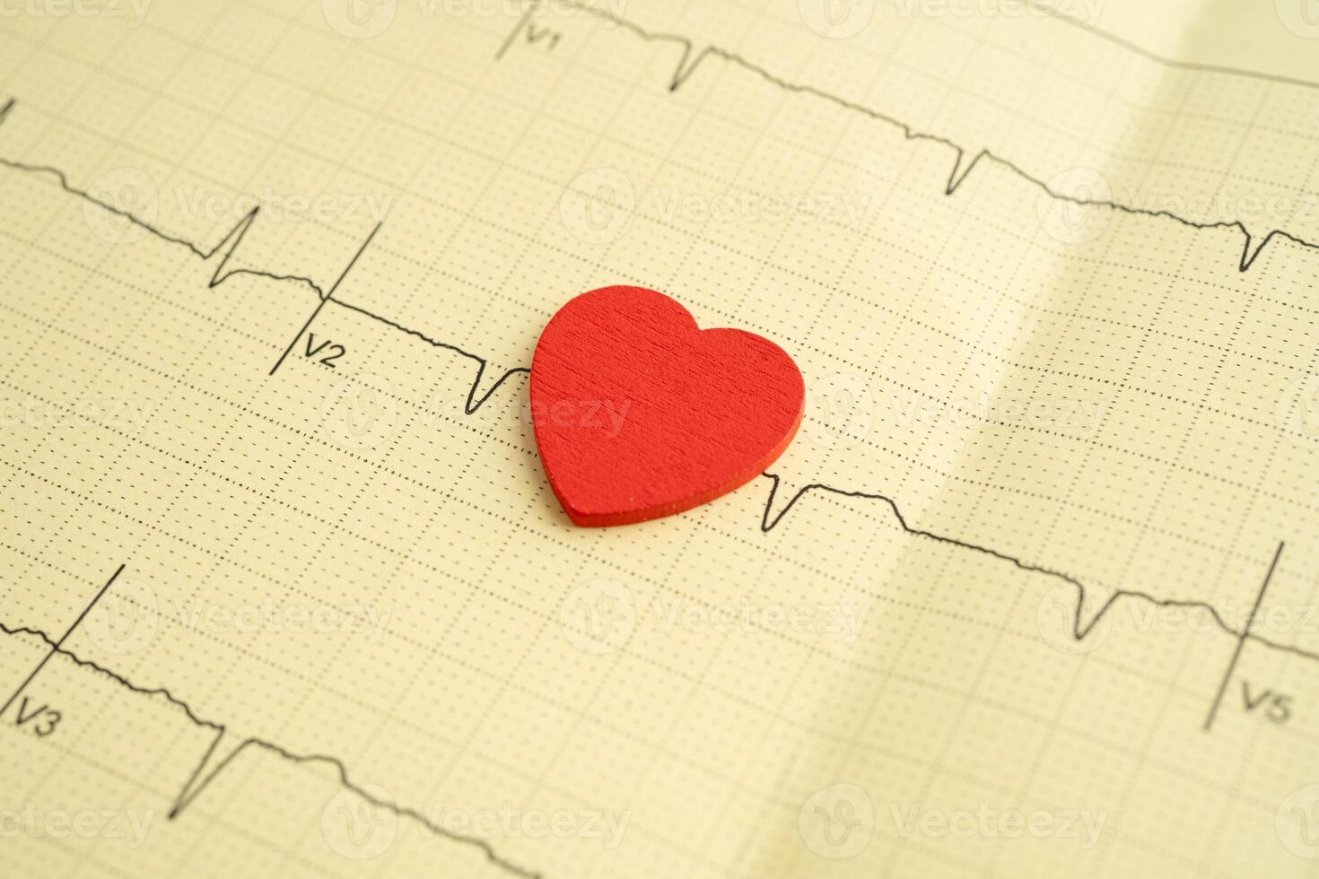 Electrocardiogram ECG, heart wave, heart attack, cardio photo
