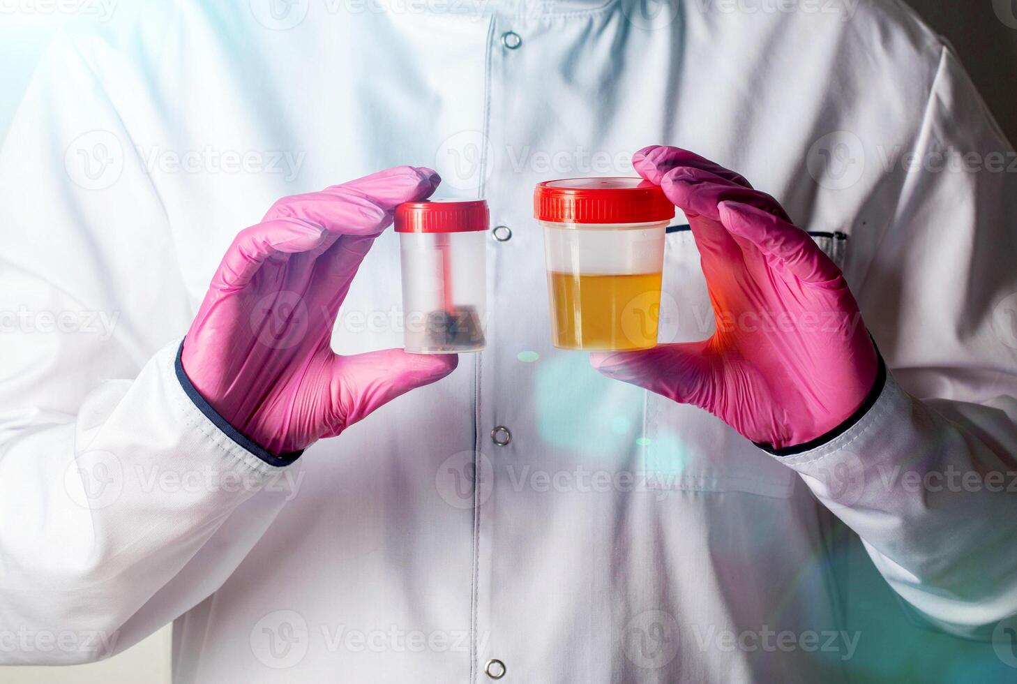 A doctor in pink gloves holds stool and urine tests. The concept of testing for infections and bacteria in urology and gastroenterology, close-up photo