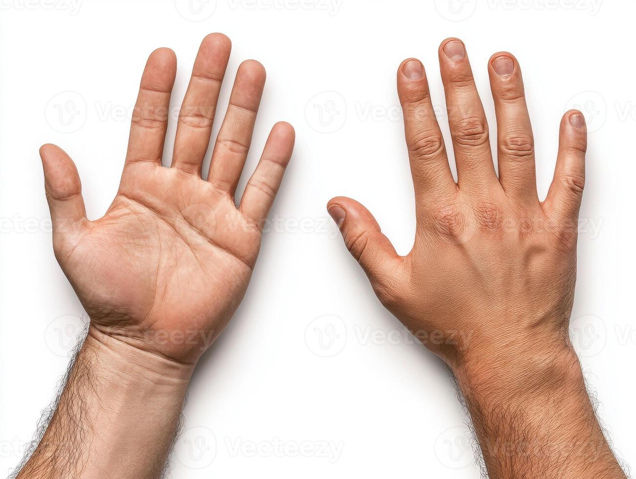 Hands showing different skin tones with prominent features photo