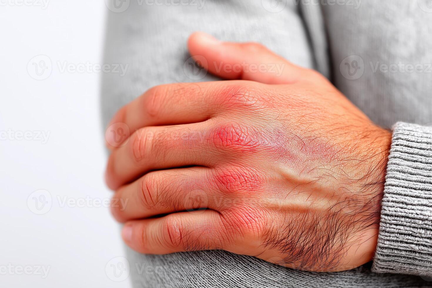 Close-up view of red irritated skin on hand suggesting allergic reaction or dermatitis against a white background. Red irritated skin on a hand showcases signs of inflammation or an allergic reaction photo