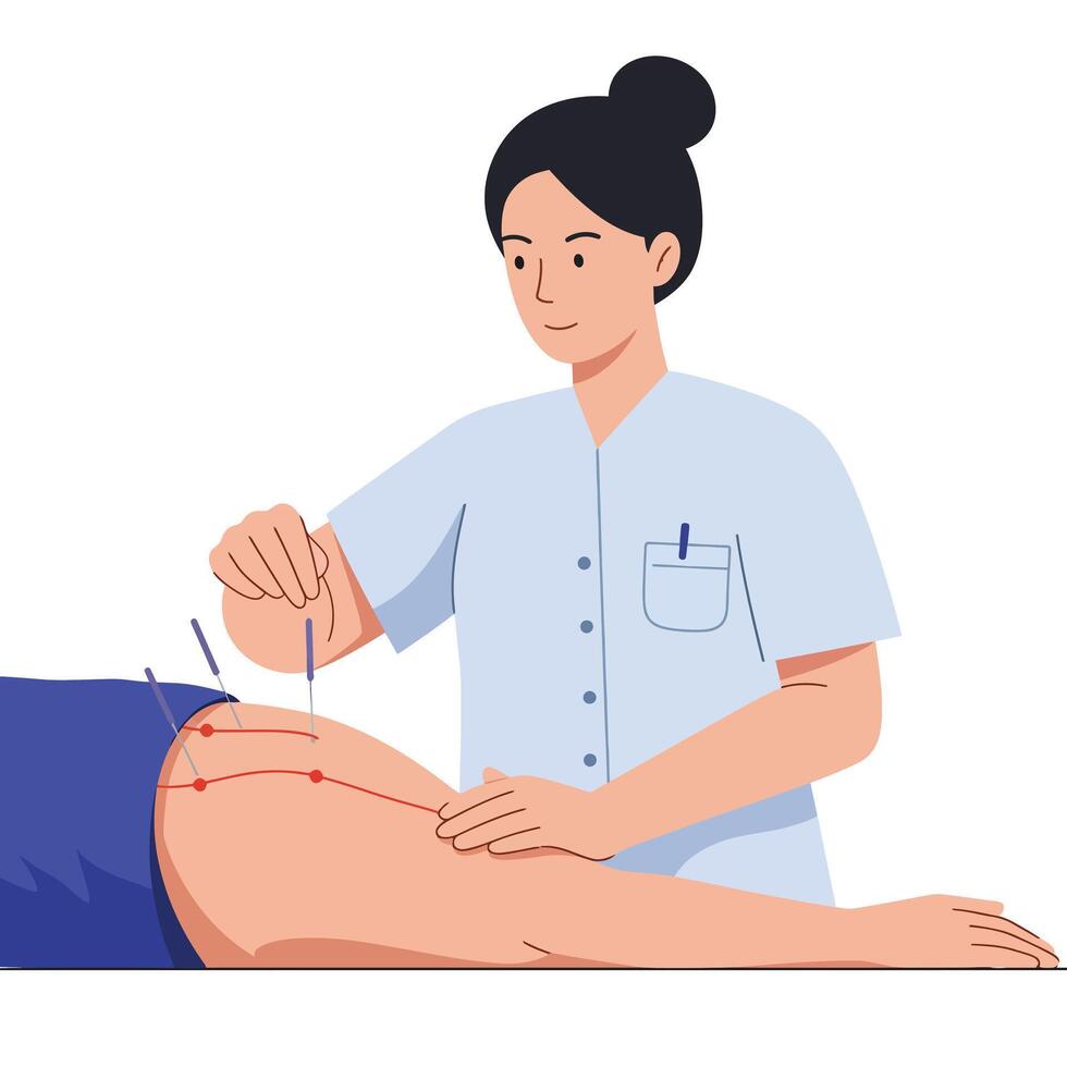 Acupuncturist performing treatment on patient in minimal illustration style art vector