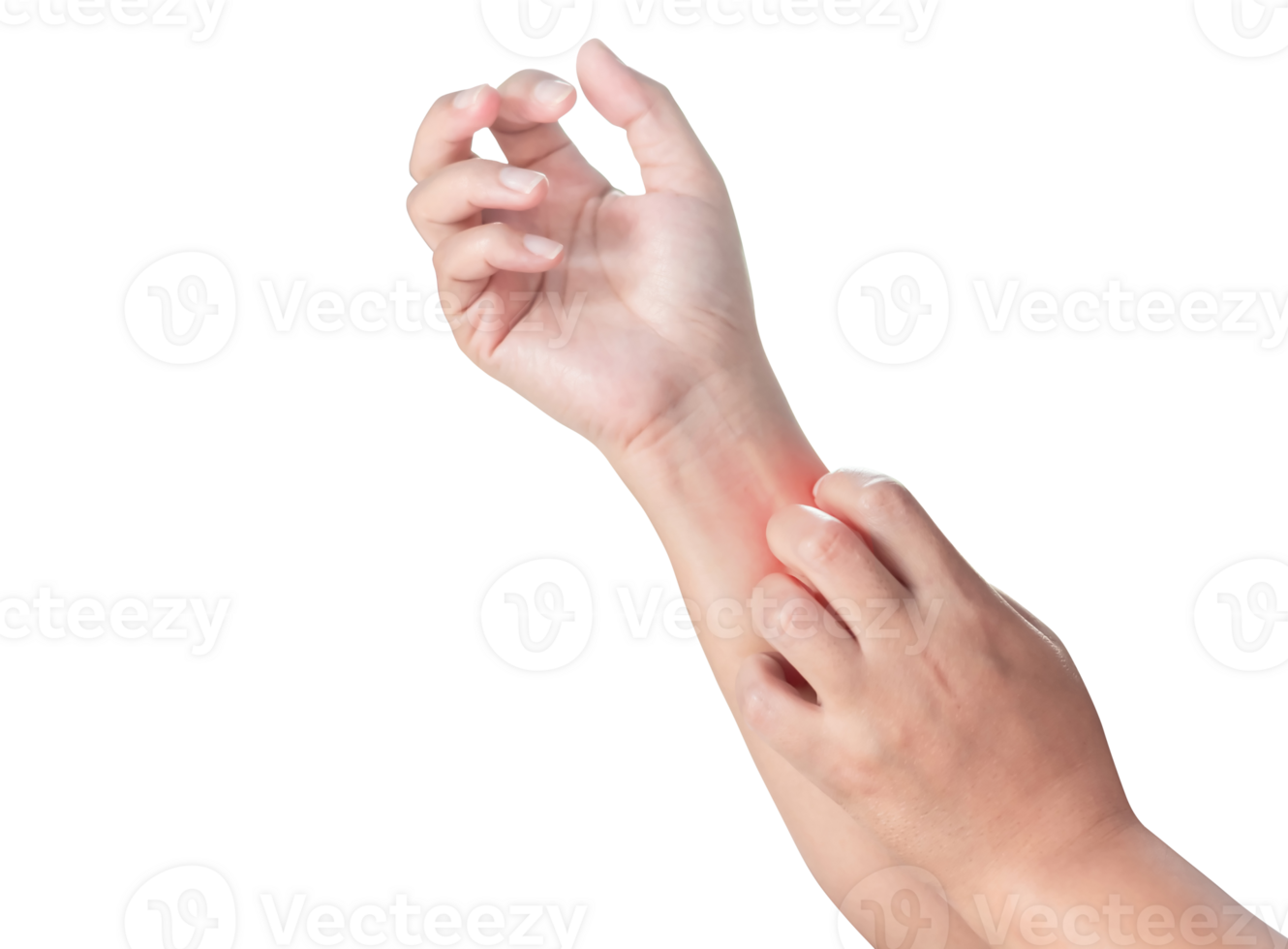 Close up woman's arm scratch the itch by hand at home, itching due to rash, fungus, allergy, dermatological disease, dry skin. Healthcare and medical concept. isolated on transparent background, File png