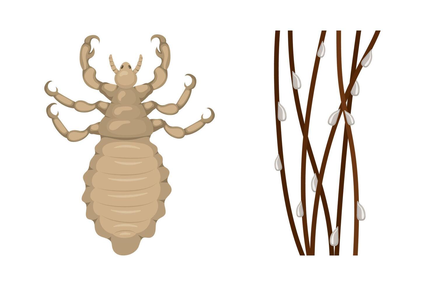 Realistic illustration of a head louse with nits attached to hair strands, infestation and the life cycle of parasite vector