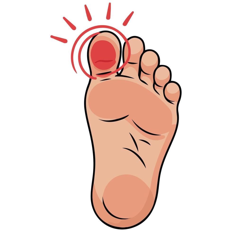 Swollen stubbed toe injury isolated illustration on white background vector