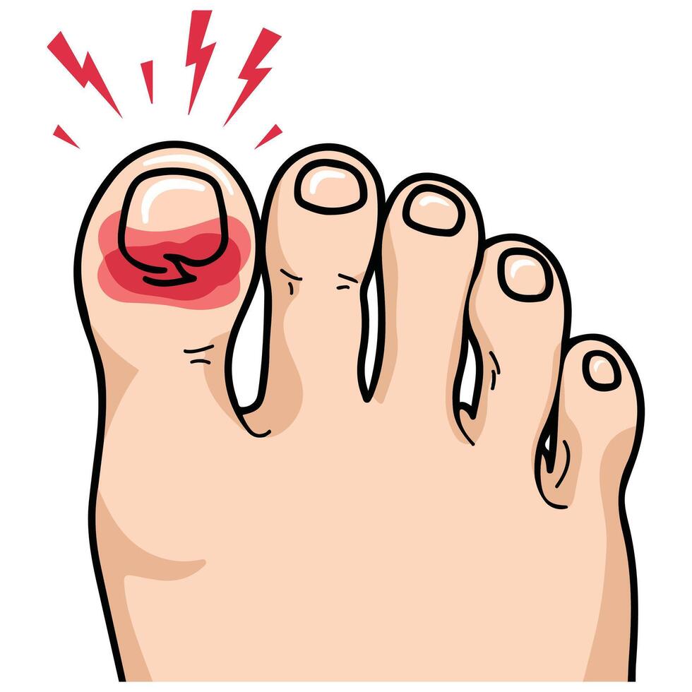 swollen inflamed big toe cartoon style isolated illustration on white background vector