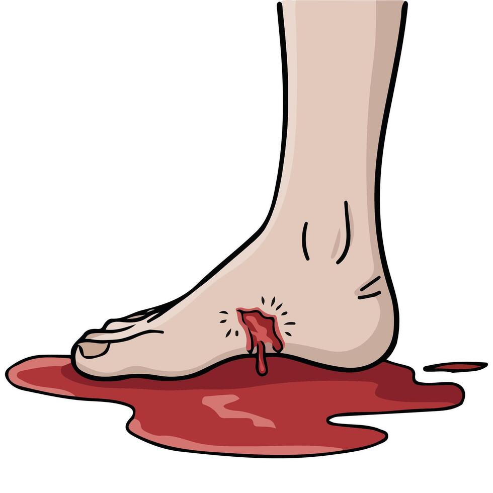 bleeding feet injury medical wound isolated illustration on white background vector