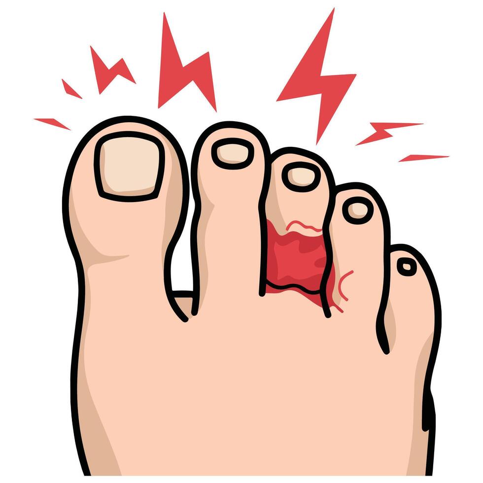 painful sore toe medical isolated illustration on white background vector