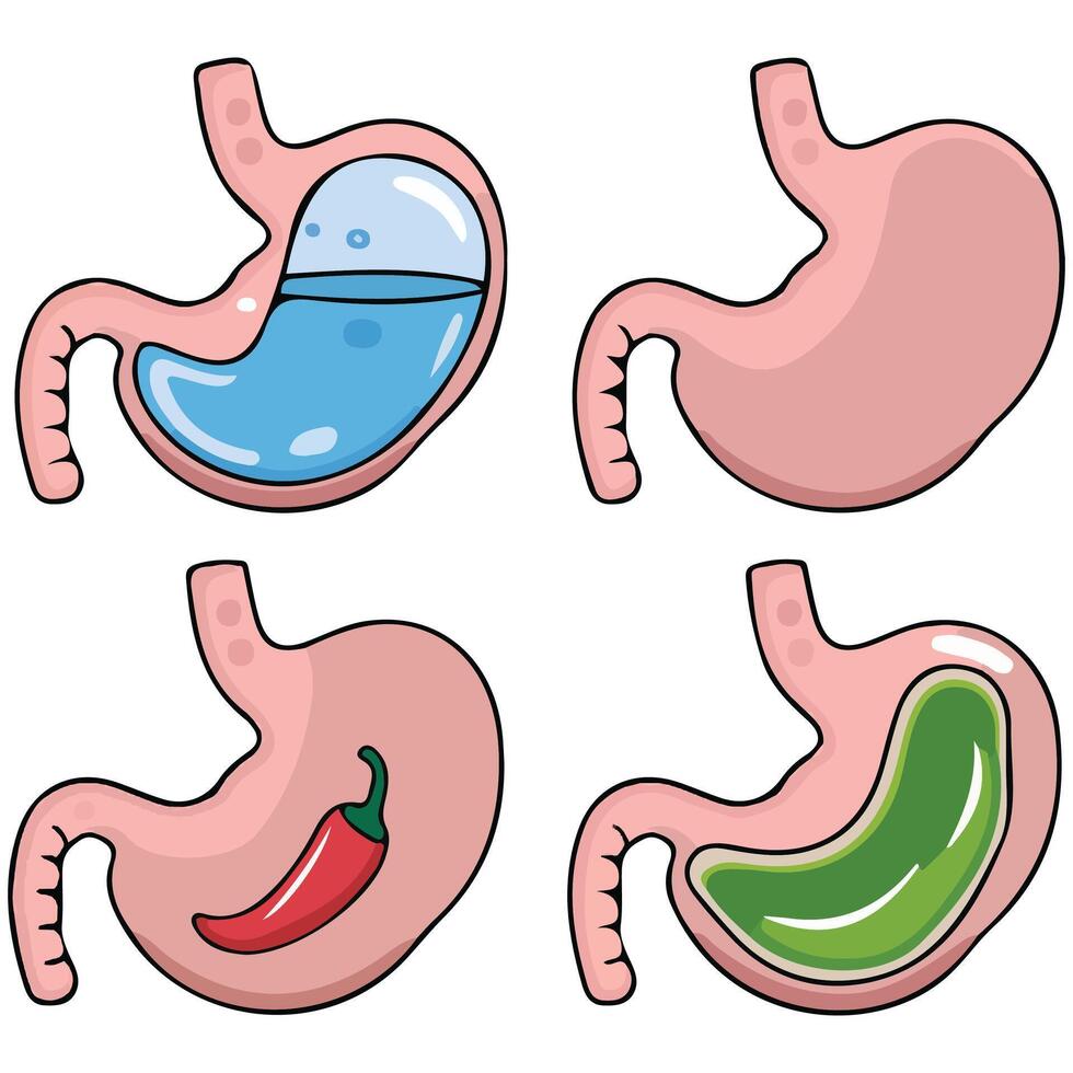 healthy unhealthy stomach comparison anatomy isolated illustration on white background vector