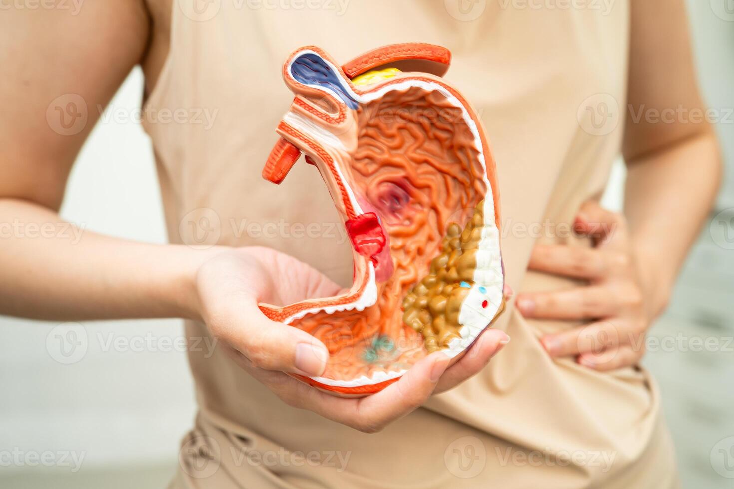 Stomach disease, Asian woman holding anatomy model for treatment in hospital. photo