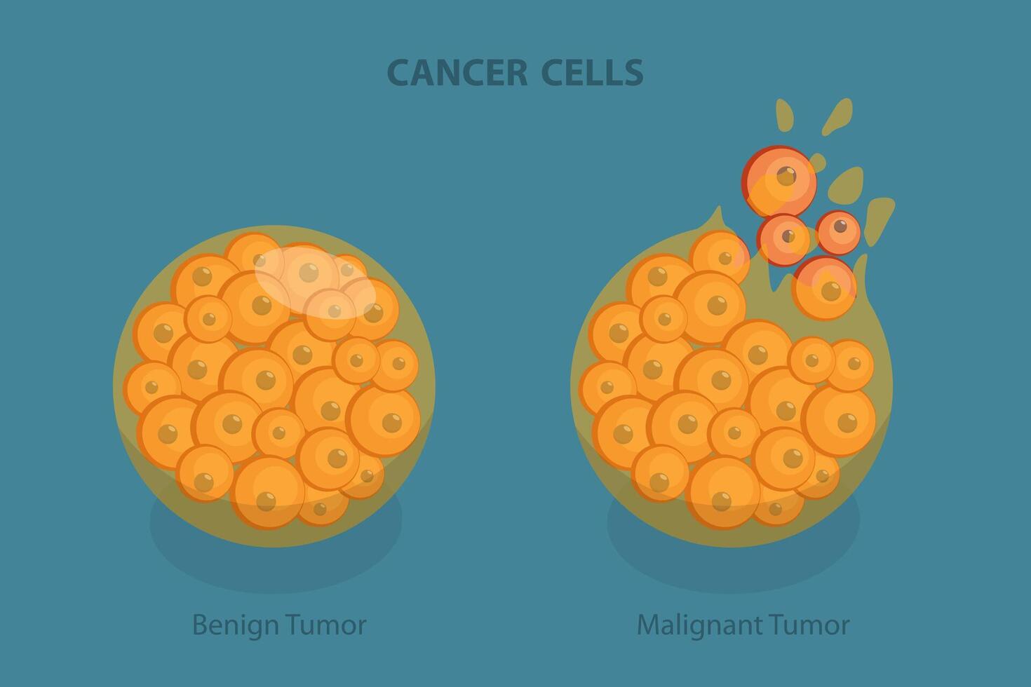 3D Isometric Flat Illustration of Cancer Cells, Tumor Development vector