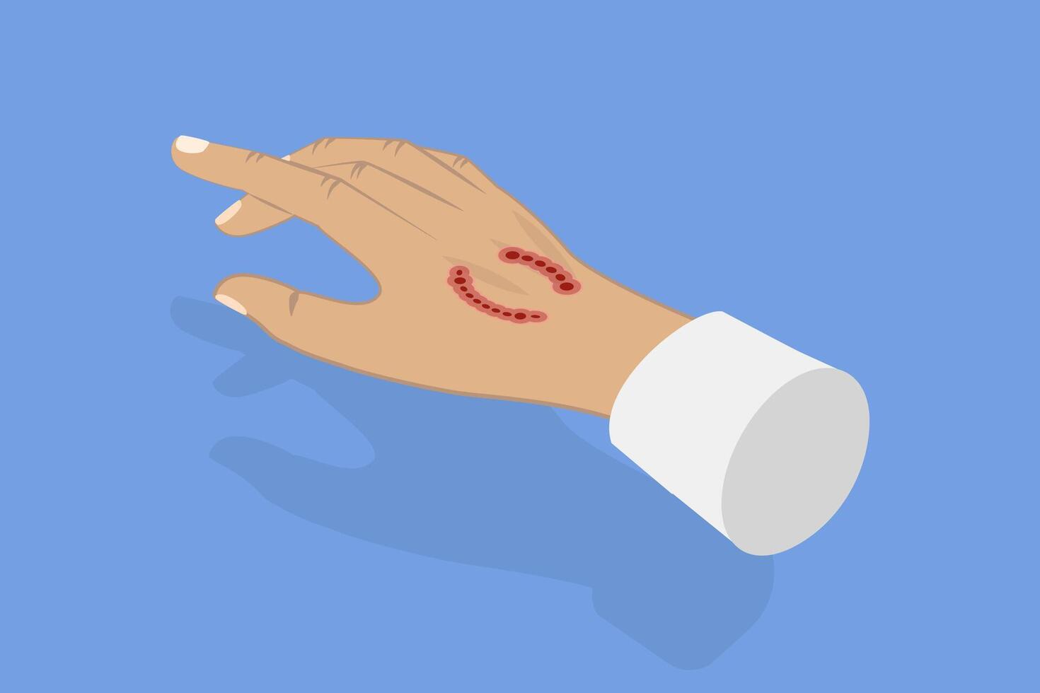 3D Isometric Flat Illustration of Dog Bite, Rabies Virus vector