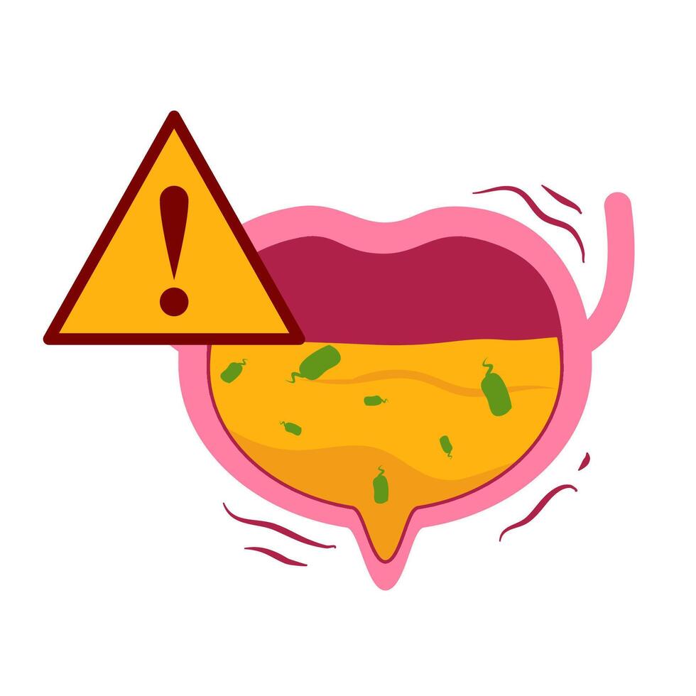 Urinary tract infection vector