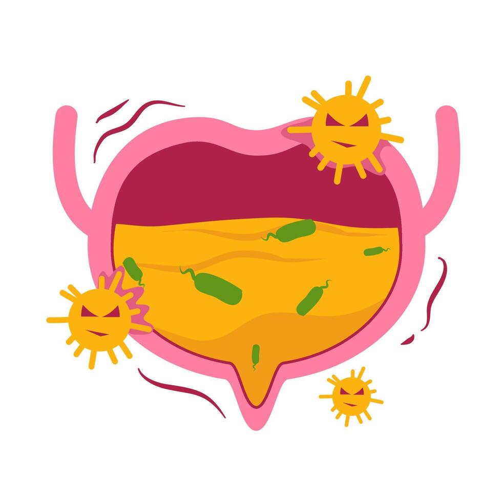 Urinary tract infection. Bladder disease. vector