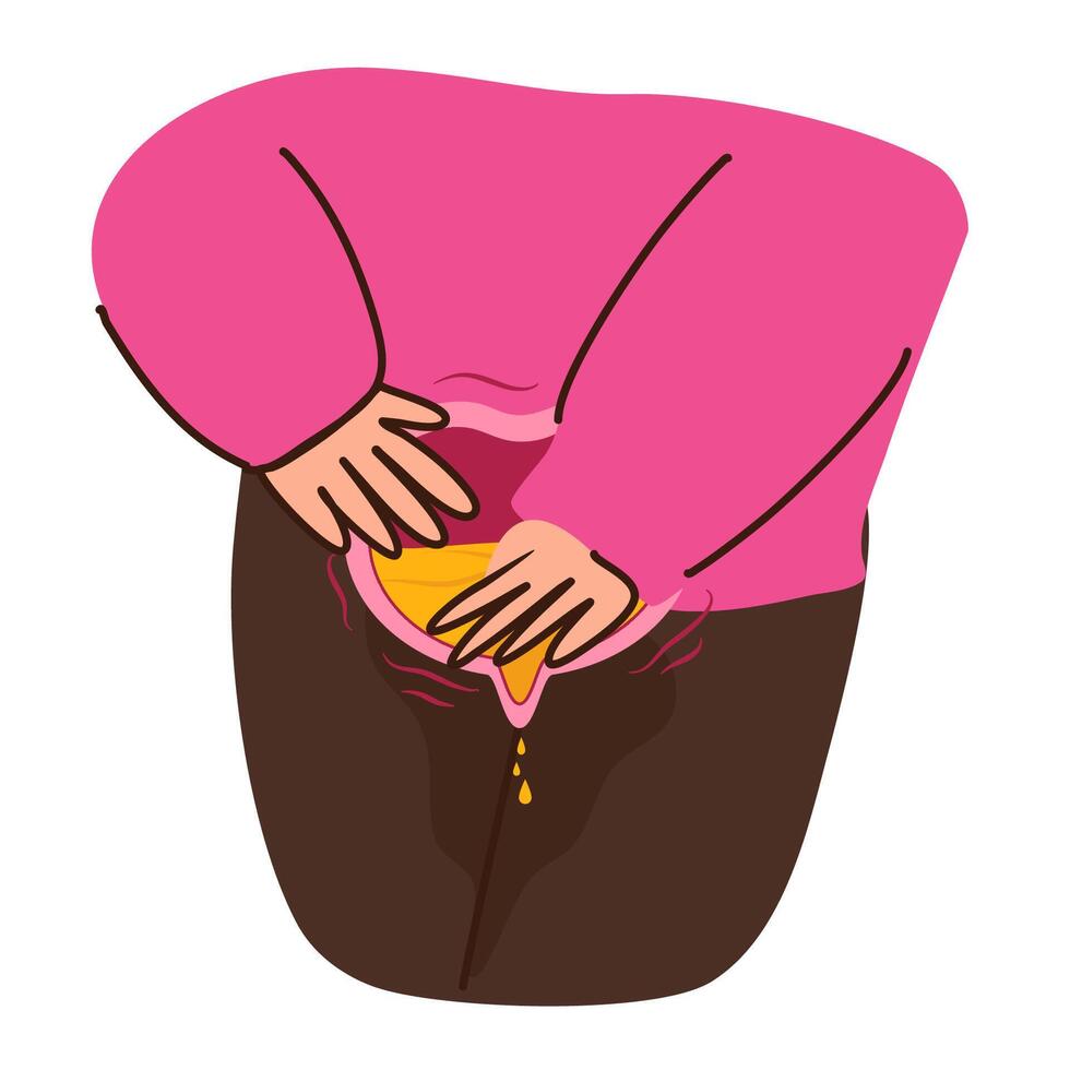 Overactive bladder illustration vector