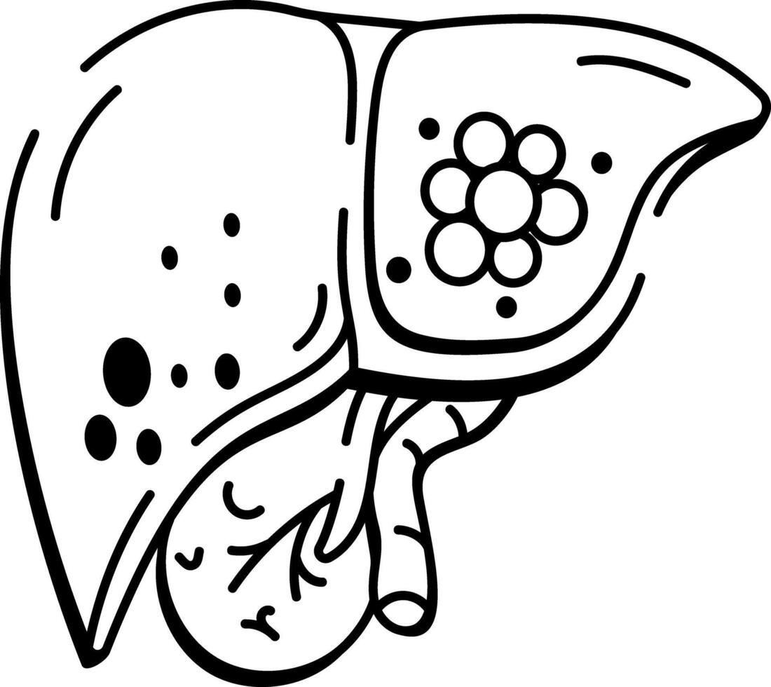 A doodle style icon depicting liver cancer vector