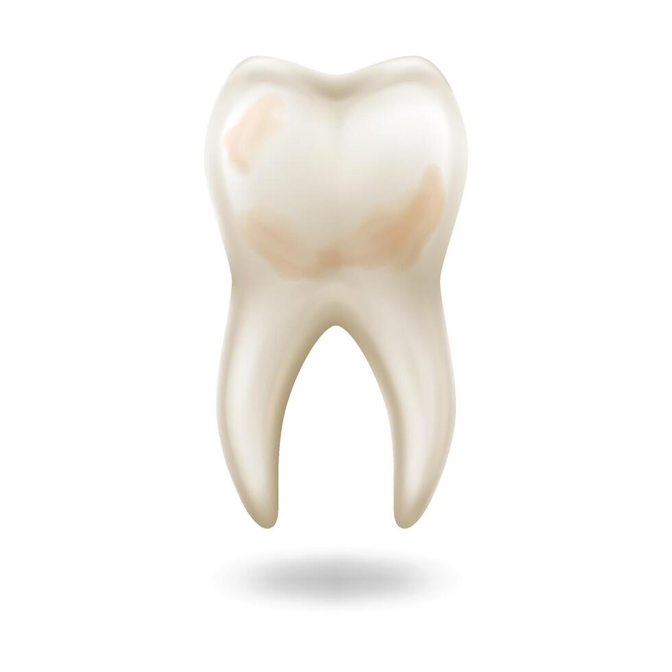 Detailed anatomical tooth illustration in realistic style displaying dental health or issues isolated on white background with copy space. vector