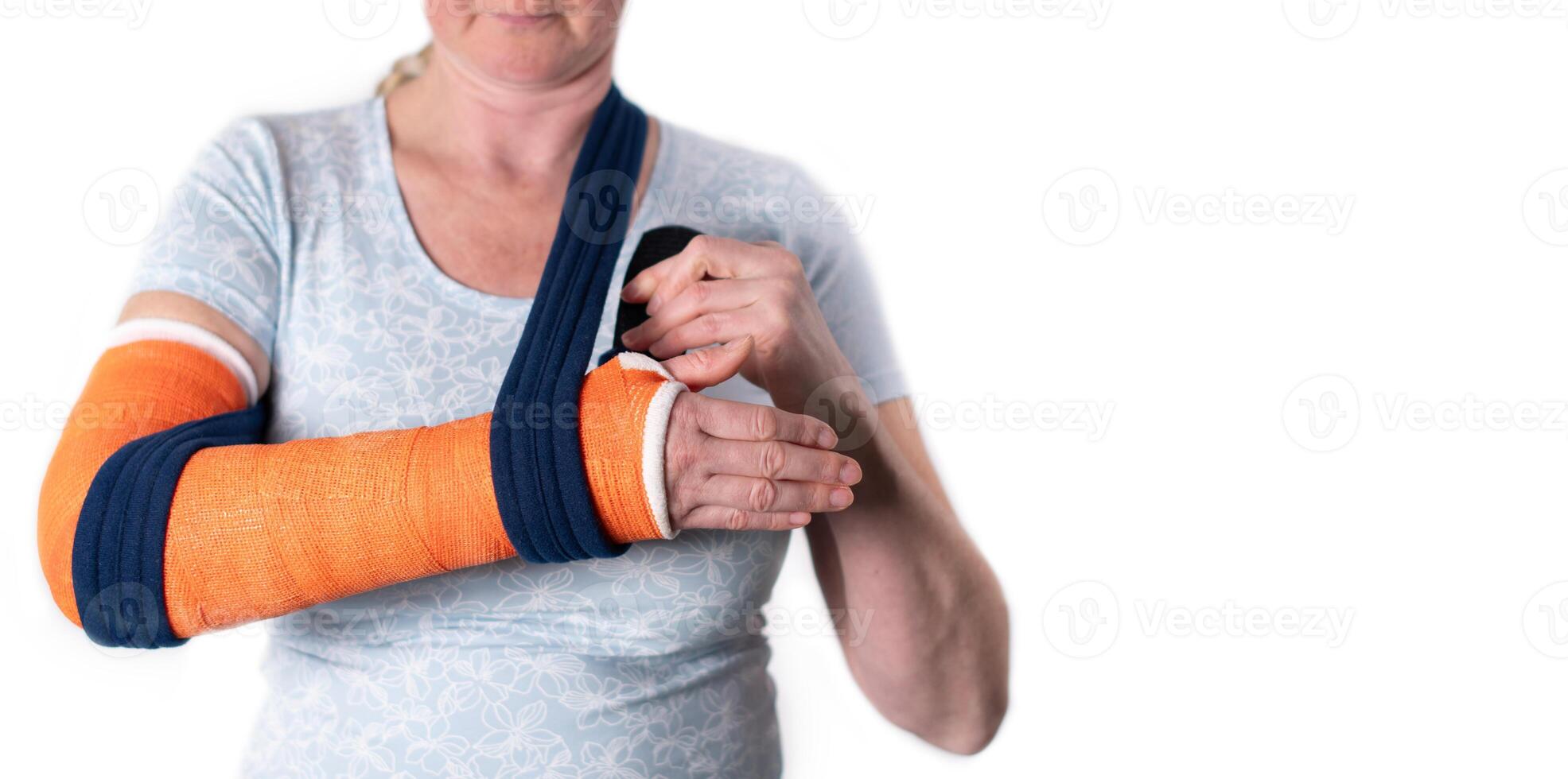 middle aged woman with broken arm in cast hangs her arm in a sling, modern treatment methods, on a neutral background, copy space, photo