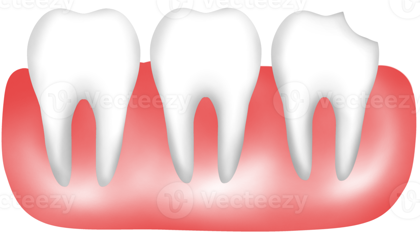Human tooth anatomy with chipped and broken features png