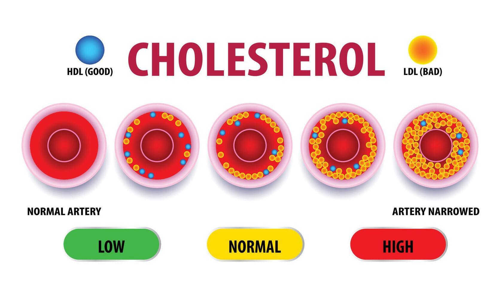 Cholesterol in artery, health risk , design vector