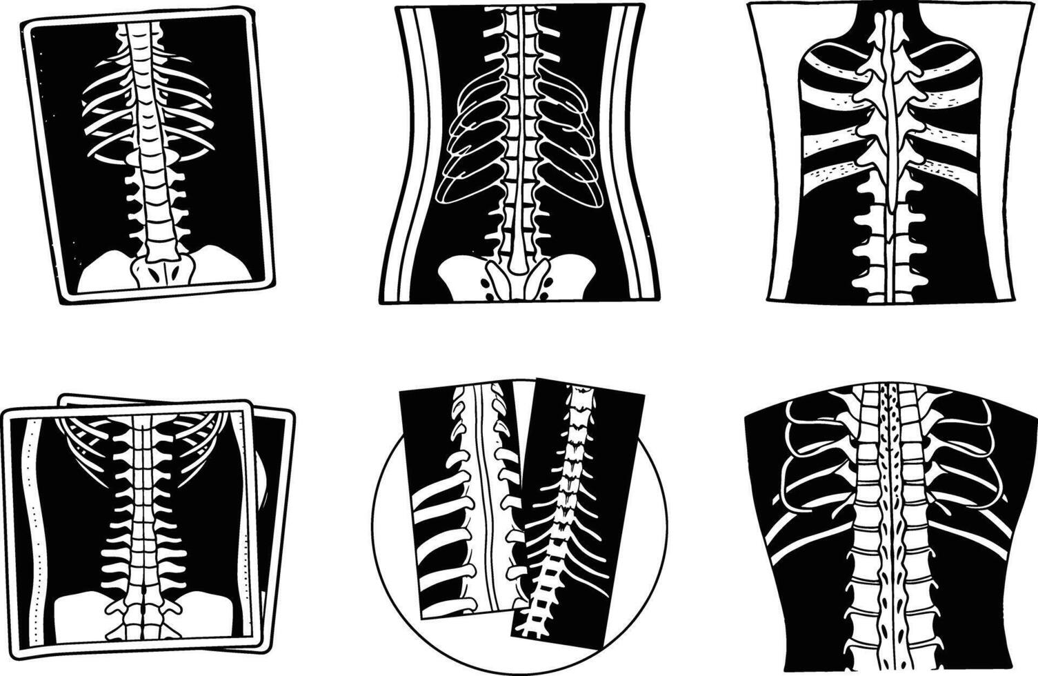 Monochrome spine and rib cage xray set anatomical illustration collection vector