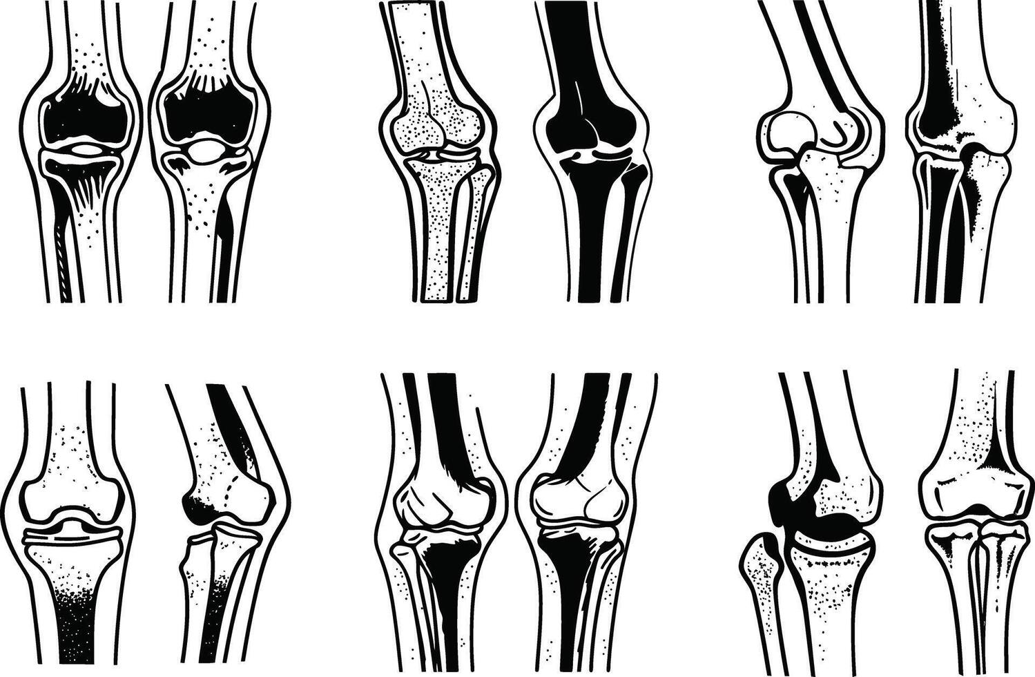 Knee joint anatomy black and white medical illustration set vector