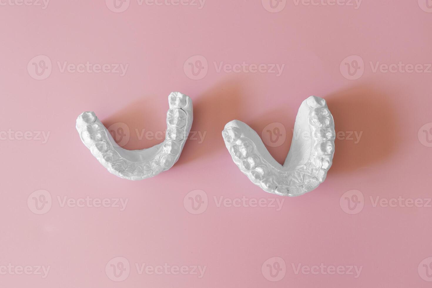 Dental casting gypsum model of human jaws on pink background. Crooked teeth and distal bite. Before treatment with braces photo