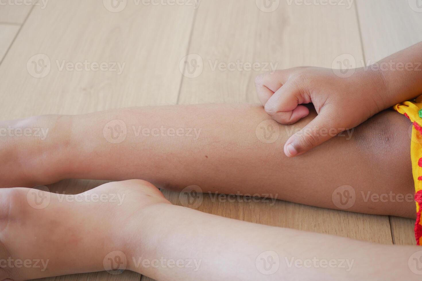 Close-up of child's leg with hand touching skin while relaxing indoors photo