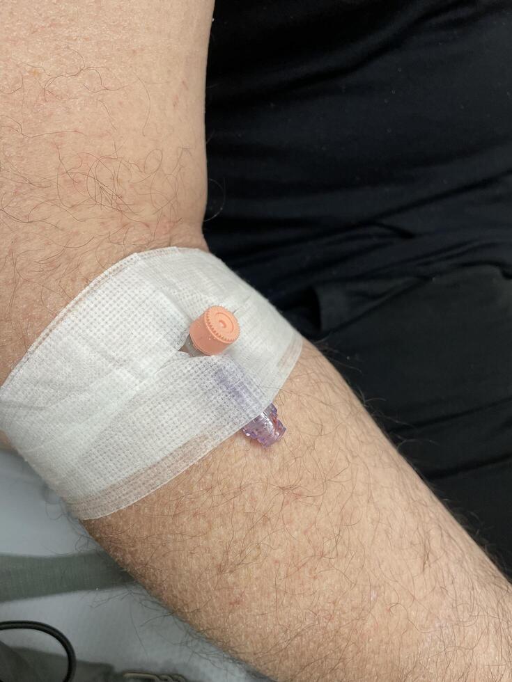 Close up of a male patients arm with an intravenous IV infusion site. photo